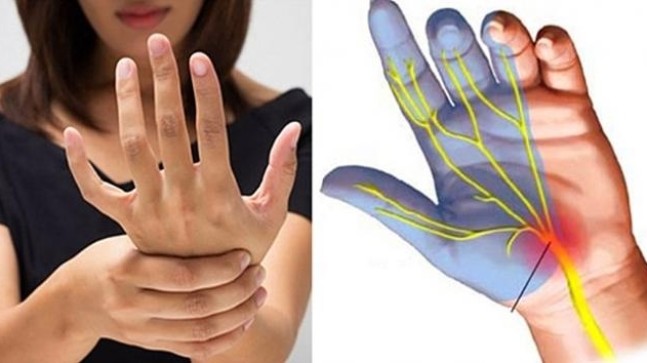 El ve Ayak Uyuşması Neyin Belirtisidir