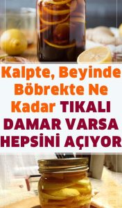 Damarlarınız Vücudunuzun Otoyolları Gibi Görev Yapar