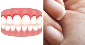 Diş Etleriniz Sık Sık şişiyor