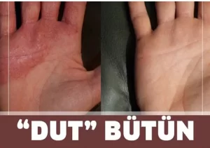 Dutun Onlarca Faydasının Beraberinde