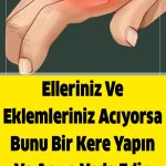 Ellerde Ve Eklemlerde Bir Ağrı Yaşarsanız