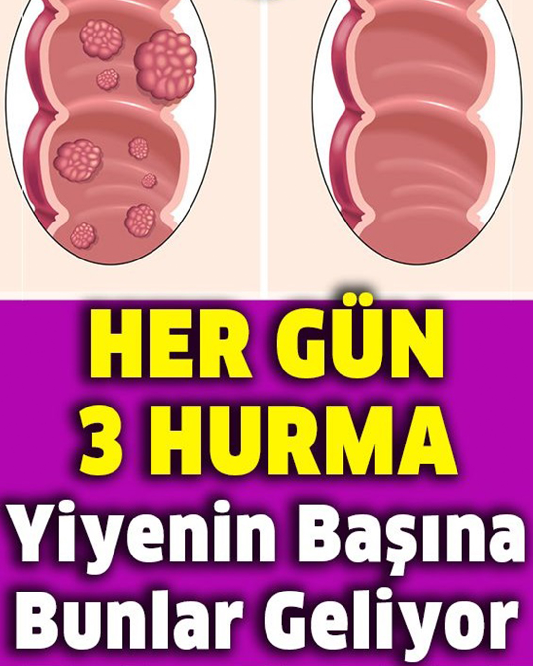 Hurma Bir Süper Besin Olarak Kabul Edilmese