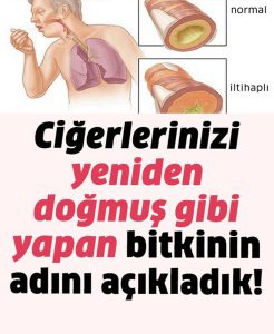 İlaçlar Yetmemeye Hastalıklar Artmaya