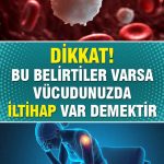 Kızarma Ile Kendini Göstermektedir
