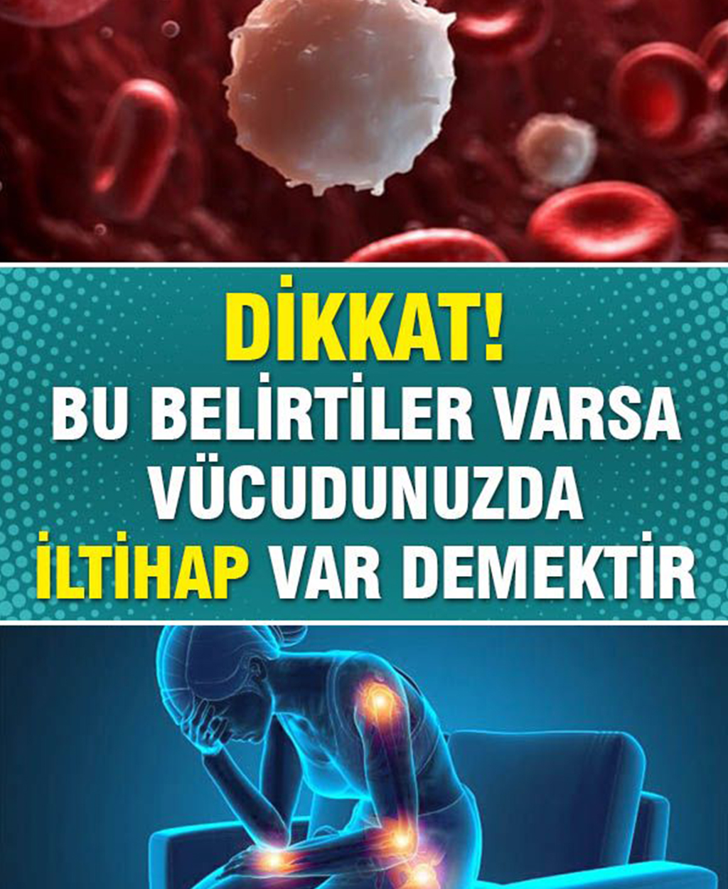 Kızarma Ile Kendini Göstermektedir