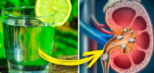 Limonun Her Sabah Bir Bardak