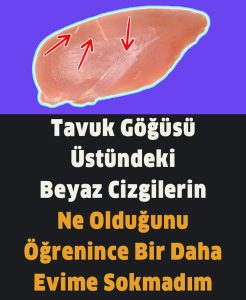Tavuk Eti Normalde Pembedir