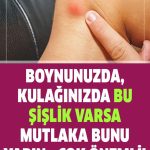 Bazı Durumlarda Bu Topaklar