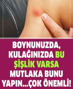 Bazı Durumlarda Bu Topaklar