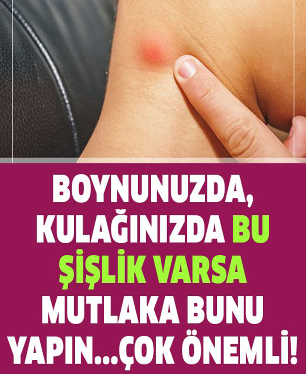 Bazı Durumlarda Bu Topaklar