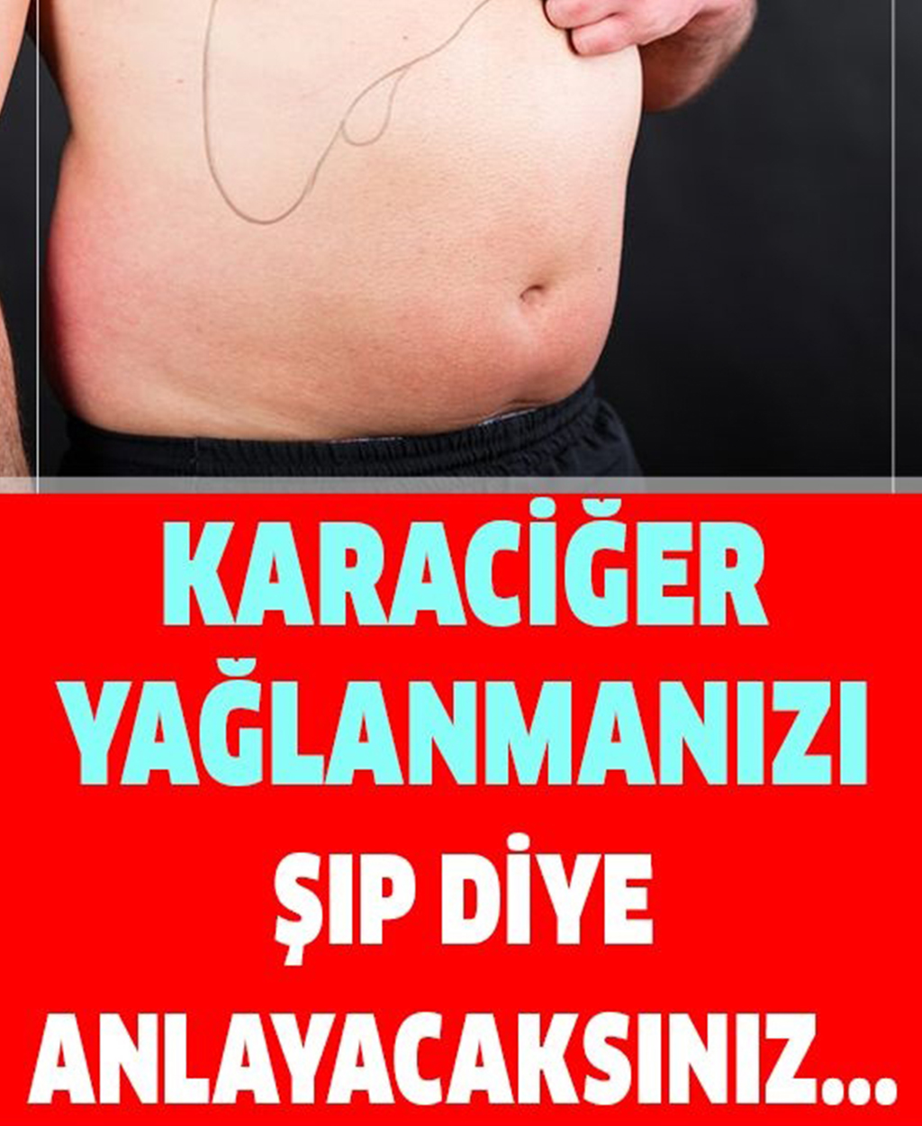 şeker Hastalığının Yağlı Karaciğer