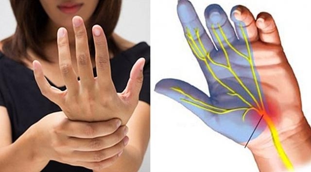 El ve Ayak Uyuşması Neyin Belirtisidir