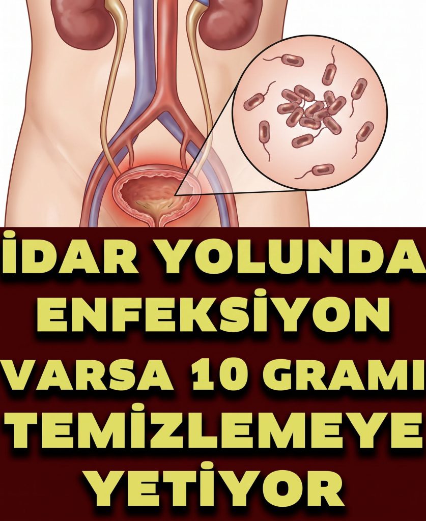 İdrar Yolu Enfeksiyonunu Geçiren 7 Doğal Yöntem - Fotoğraf 2