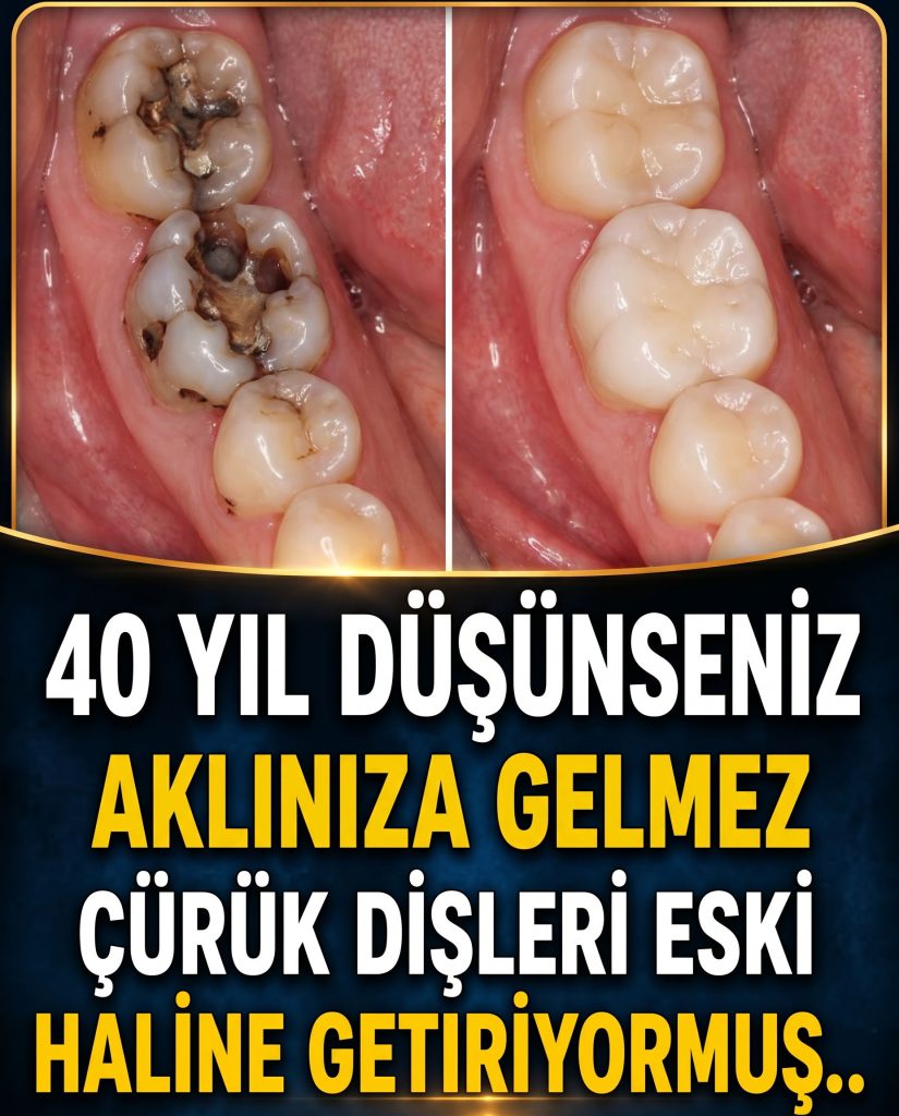 40 yıl düşünseniz aklınıza gelmez! Dişteki tartarları birkaç günde tamamen yok ediyor - Fotoğraf 2